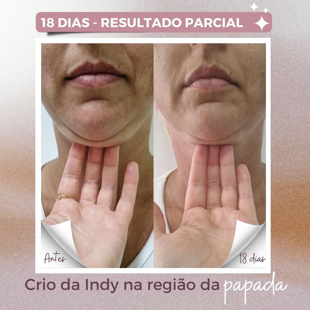 A_D_Papoda